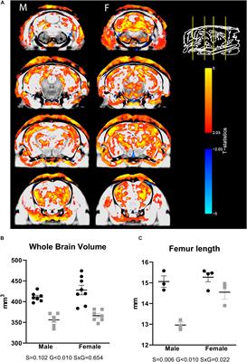 Effects of Long-Term Endogenous Corticosteroid Exposure on Brain Volume and Glial Cells in the AdKO Mouse